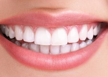 مشاكل الأسنان تزداد