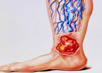 عوامل تزيد من خطر