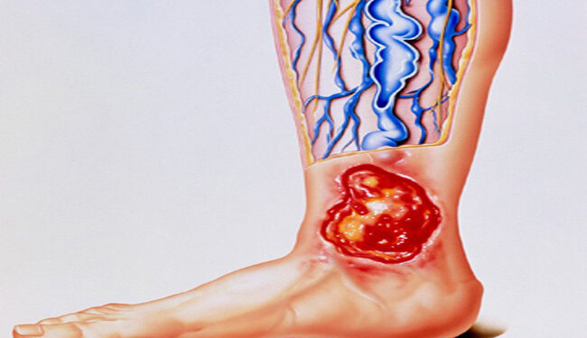 عوامل تزيد من خطر