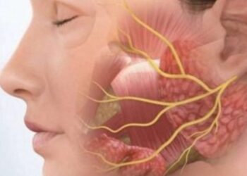 مرض العصب السابع