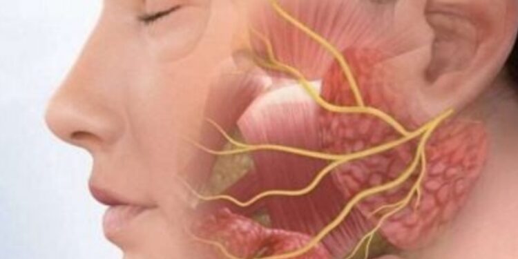 مرض العصب السابع