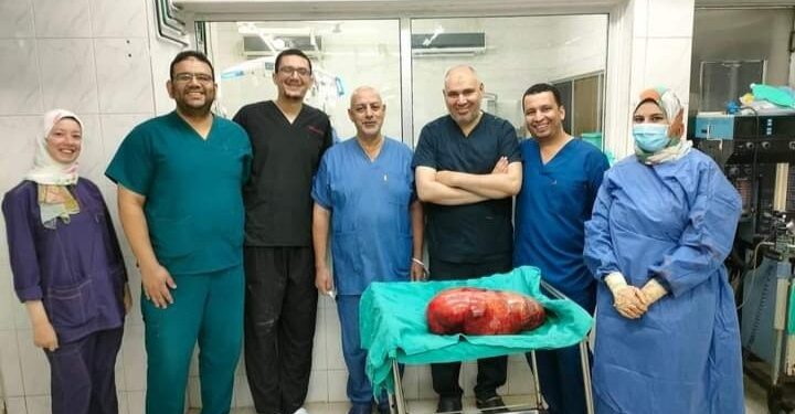 “معجزة طبية” في معهد أورام طنطا ..استئصال ورم يزن 18 كيلو جرام