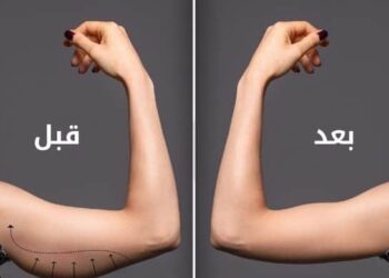 أسباب لجوء النساء