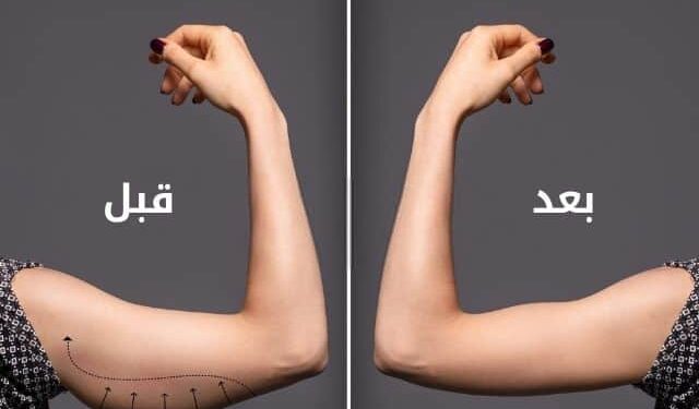 أسباب لجوء النساء