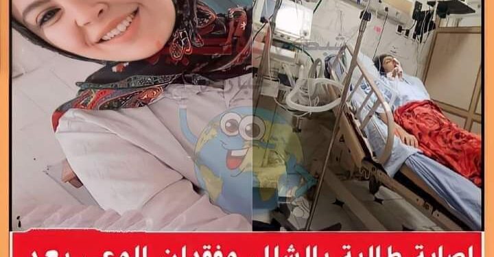 إصابة طالبة بالشلل وفقدان الوعى بعد جراحة إستئصال زايده بالزقازيق بالشرقية