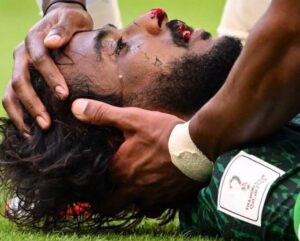 بسبب الإصابة القوية ياسر الشهراني خارج مباريات كأس العالم