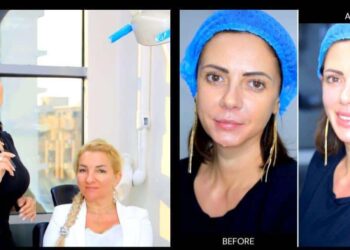 حقائق عمليات تجميل الوجه الزائدة وفوائد الفيلر والبوتوكس!