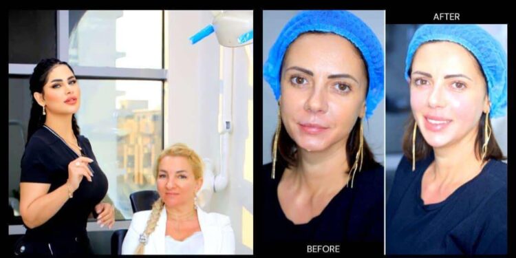 حقائق عمليات تجميل الوجه الزائدة وفوائد الفيلر والبوتوكس!