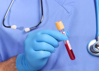 عقار جديد يساعد في إزالة فيروس نقص المناعة البشرية من خلايا المخ