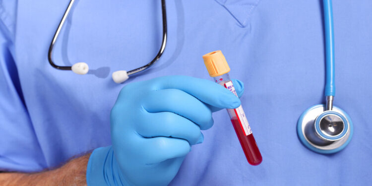 عقار جديد يساعد في إزالة فيروس نقص المناعة البشرية من خلايا المخ