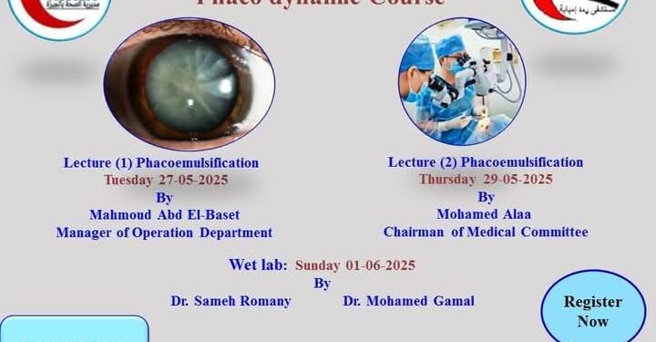 فرصة مميزة لشباب الأطباء للتدريب بمجال عمليات المياه البيضاء بمستشفى رمد إمبابة