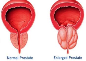 مشاكل ما بعد الخمسين عند الرجال رعب البروستات